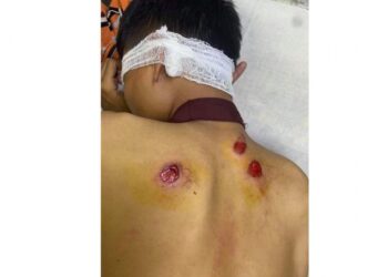 လူထောင်ချီပါဝင်သည့် တောင်ဥက္ကလာထိုင်သပိတ် ဖြိုခွင်းခံရပြီး ၁၇ ဦး အဖမ်းခံရ