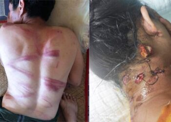 ‘Military dogs bite,’ soldiers tell protesters as they inflict vicious beatings