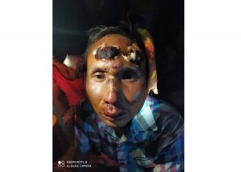 Security forces beat, arrest people for holding vigil in Bago Region