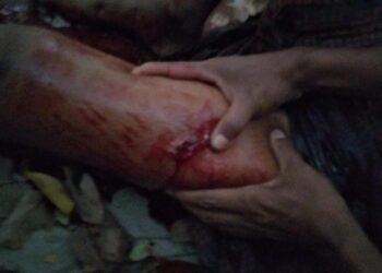 စဉ့်ကူးနှင့် သပိတ်ကျင်းတွင် စစ်ကောင်စီလက်နက်ကိုင်များ ပစ်ခတ်မှုကြောင့် ၅ ဦးသေဆုံးခဲ့