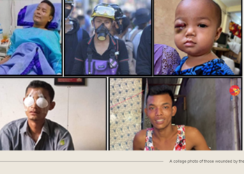 Profiles of Some of the Hundreds Wounded at the Hands of Myanmar’s Regime