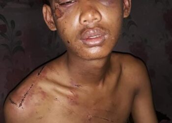 A young boy was tortured like this by the military terrorists