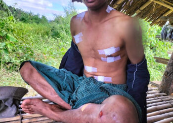 Chin man abducted, tortured by Myanmar army manages to escape